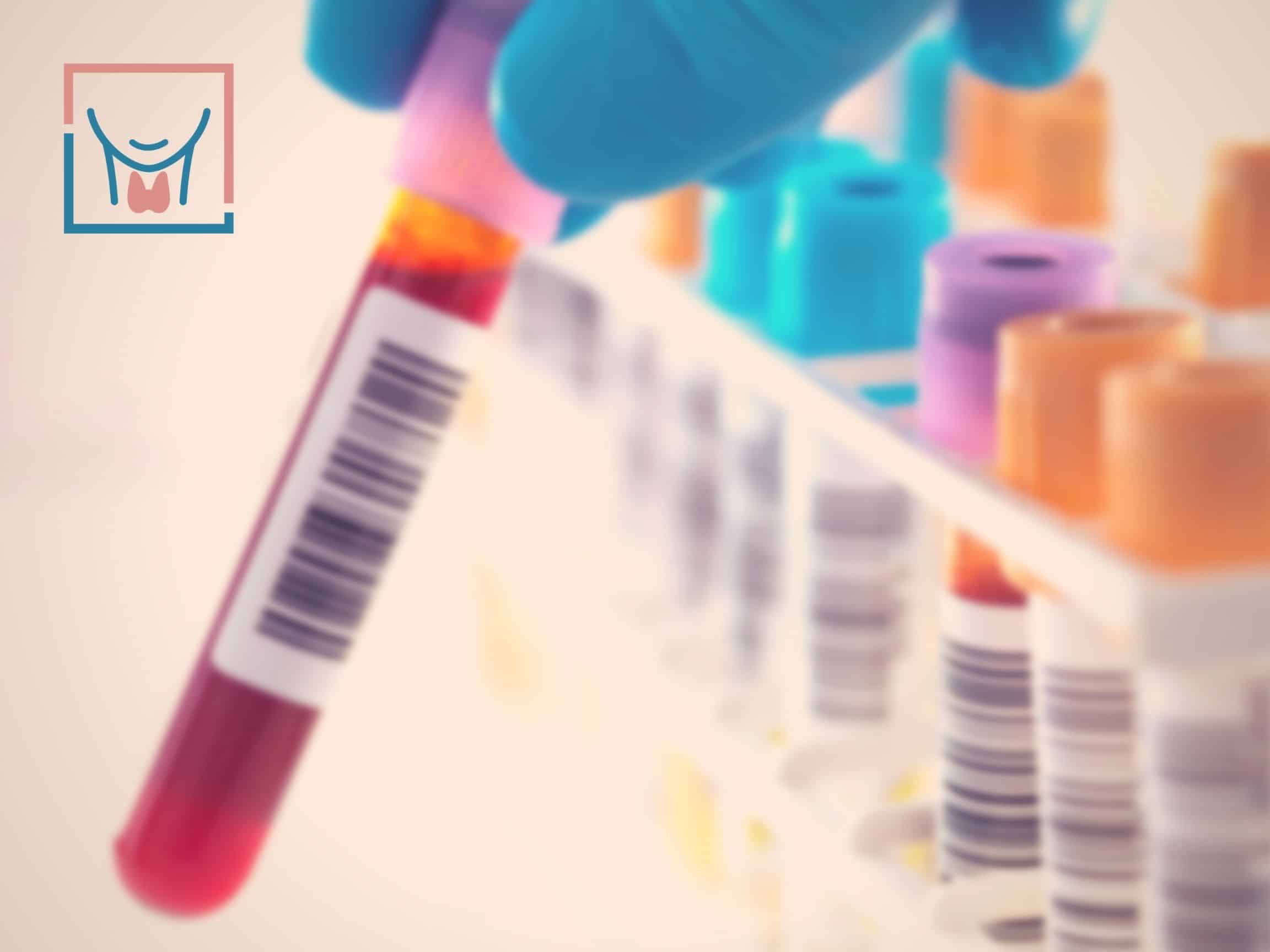 normal thyroid levels, What is a normal TSH level, hormone